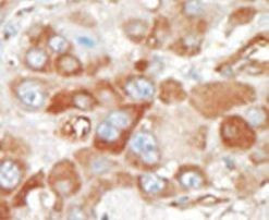 SRPK2 Antibody in Immunohistochemistry (IHC)