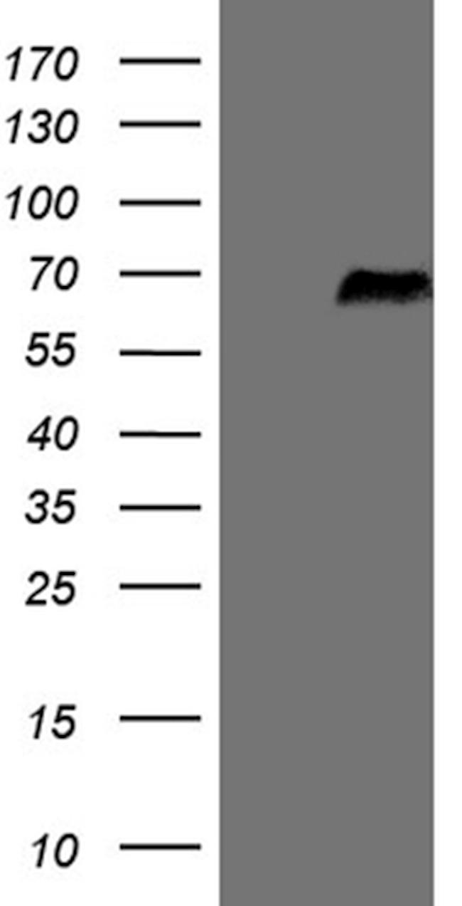 SRPK3 Antibody in Western Blot (WB)