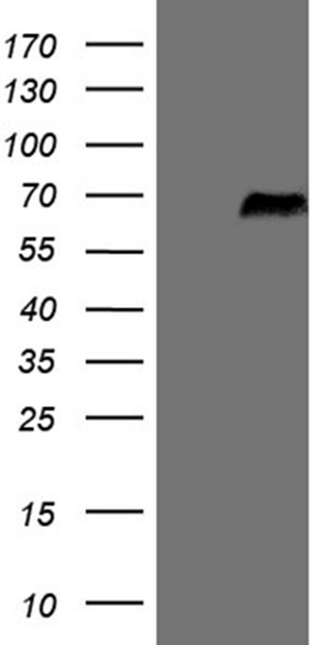 SRPK3 Antibody in Western Blot (WB)