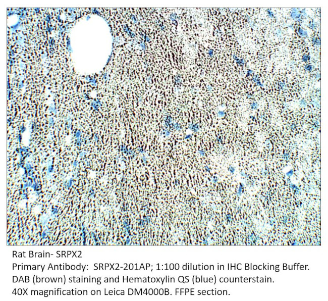 SRPX2 Antibody in Immunohistochemistry (IHC)