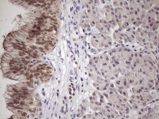 SRSF9 Antibody in Immunohistochemistry (Paraffin) (IHC (P))