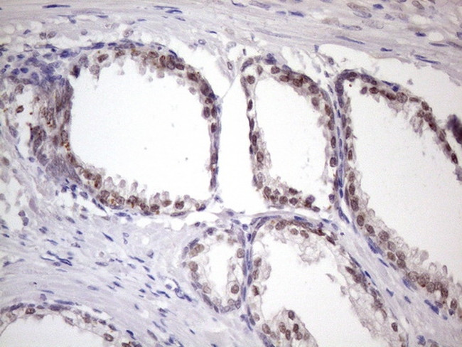 SRSF9 Antibody in Immunohistochemistry (Paraffin) (IHC (P))