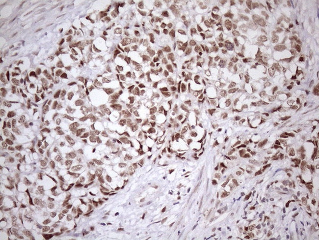 SRSF9 Antibody in Immunohistochemistry (Paraffin) (IHC (P))