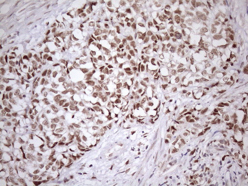 SRSF9 Antibody in Immunohistochemistry (Paraffin) (IHC (P))