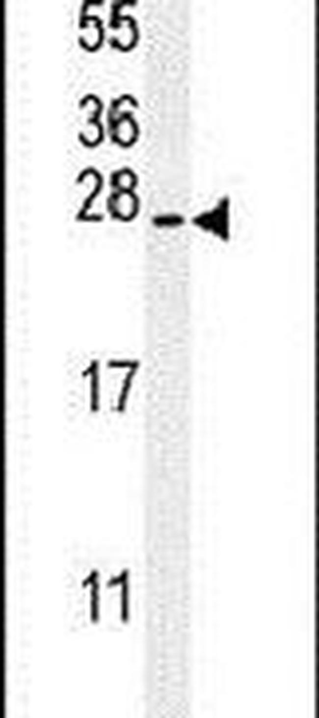 SERTAD3 Antibody in Western Blot (WB)