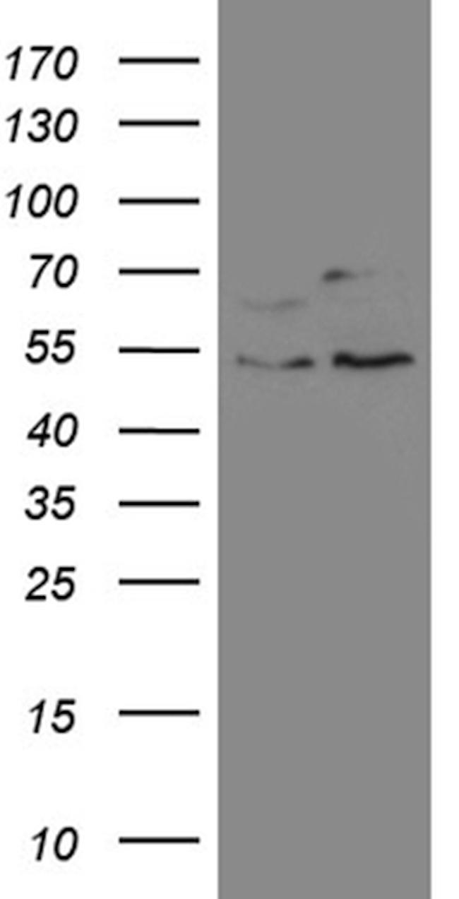 SS18 Antibody in Western Blot (WB)