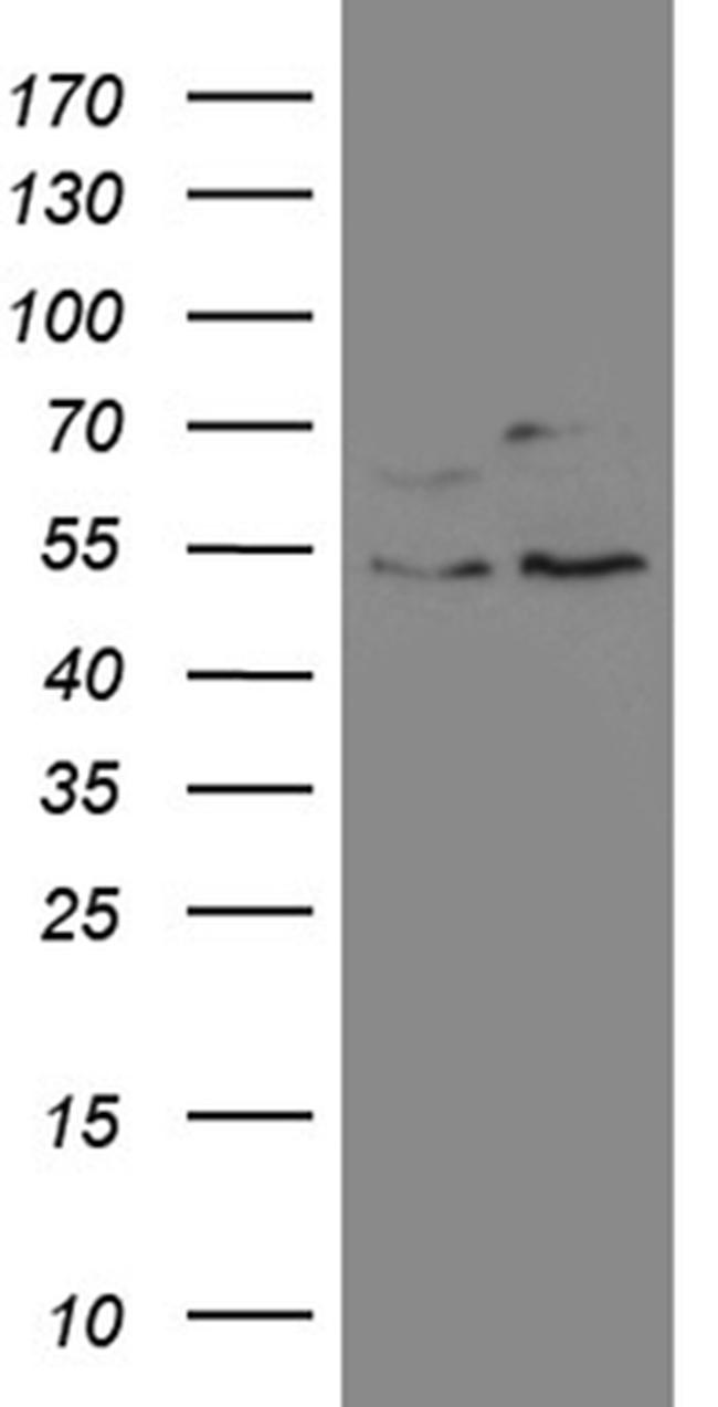 SS18 Antibody in Western Blot (WB)