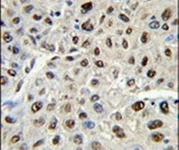 SSB Antibody in Immunohistochemistry (IHC)