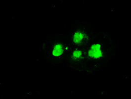 SSB Antibody in Immunocytochemistry (ICC/IF)