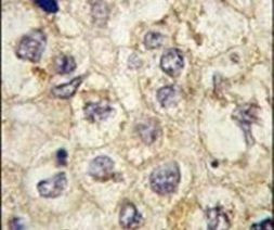 TRAP alpha Antibody in Immunohistochemistry (IHC)
