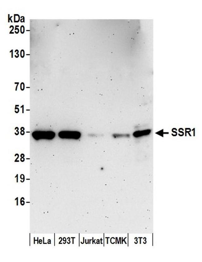 SSR1/TRAP alpha Antibody in Western Blot (WB)