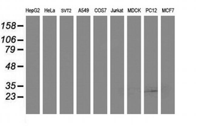 SSR1 Antibody in Western Blot (WB)