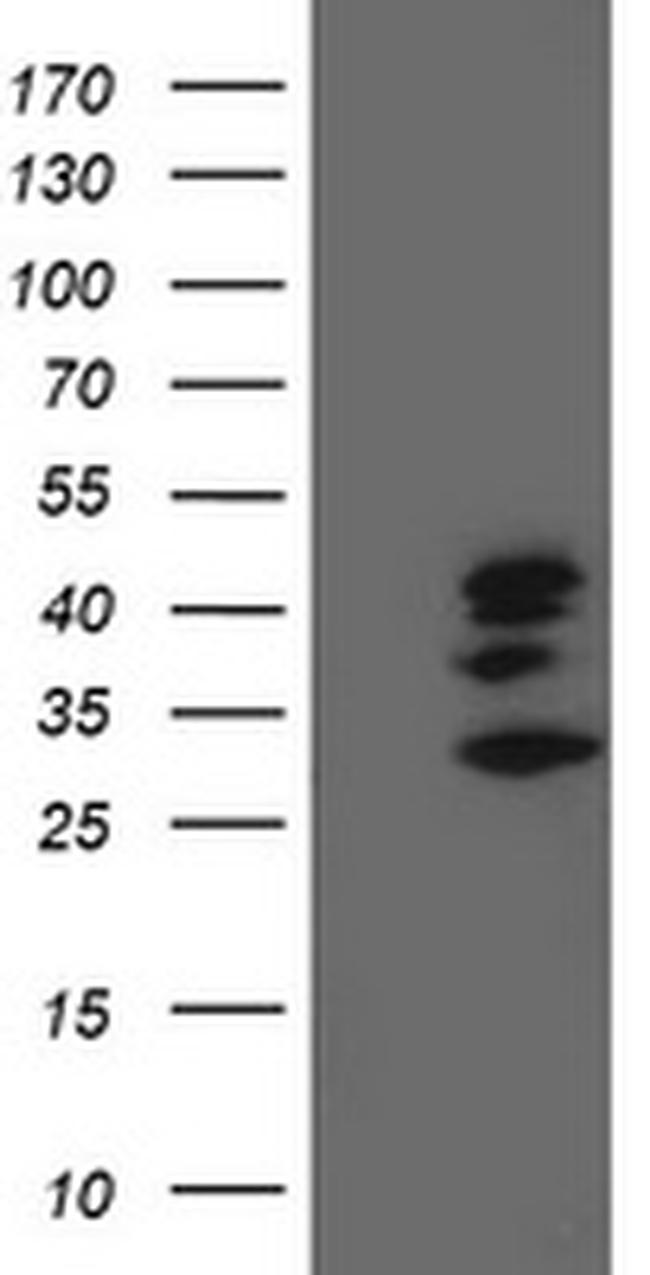 SSR1 Antibody in Western Blot (WB)