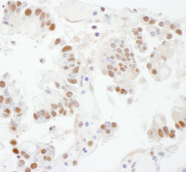 SSRP1 Antibody in Immunohistochemistry (IHC)