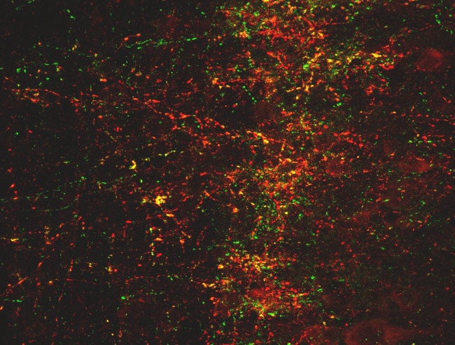 SSTR1 Antibody in Immunocytochemistry (ICC/IF)