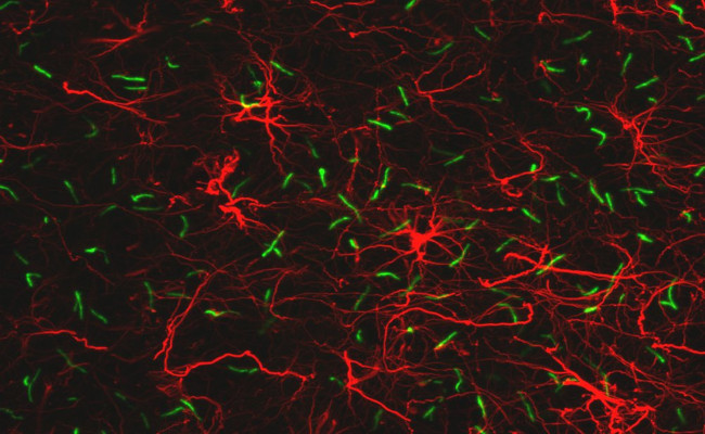 SSTR3 Antibody in Immunocytochemistry (ICC/IF)
