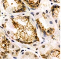 SSTR1 Antibody in Immunohistochemistry (IHC)