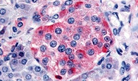 SSTR1 Antibody in Immunohistochemistry (Paraffin) (IHC (P))