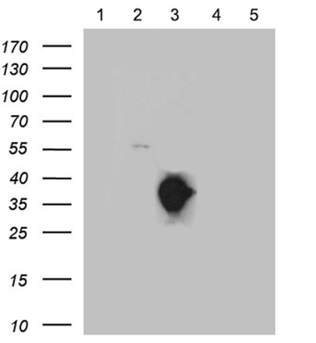 SSTR3 Antibody in Western Blot (WB)