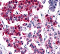 SSTR4 Antibody in Immunohistochemistry (IHC)