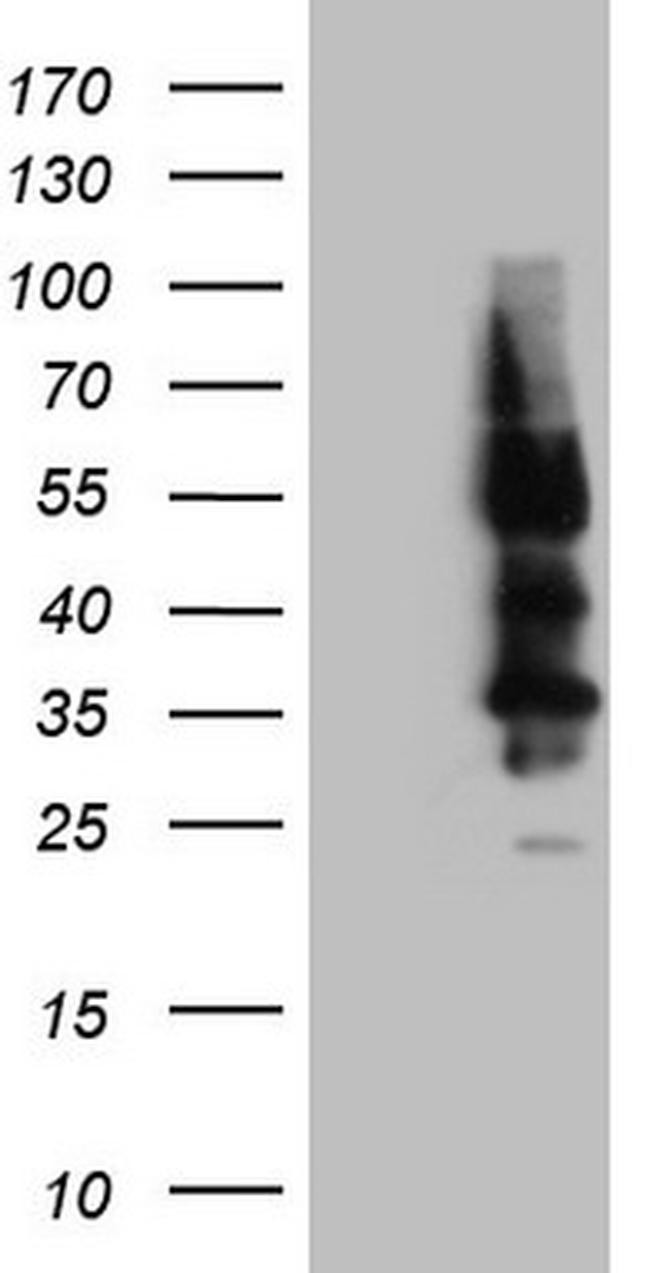 SSTR4 Antibody in Western Blot (WB)