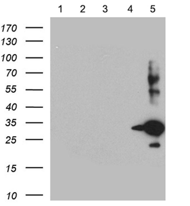 SSTR5 Antibody in Western Blot (WB)