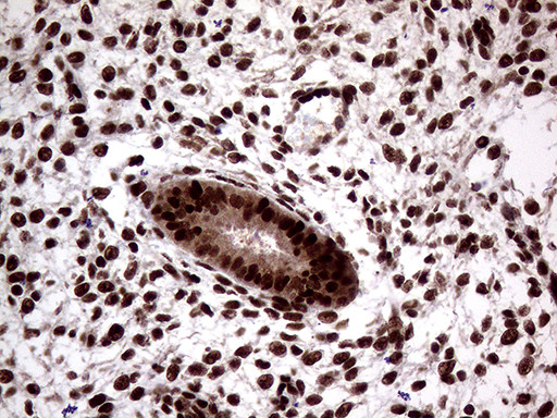 SSU72 Antibody in Immunohistochemistry (Paraffin) (IHC (P))
