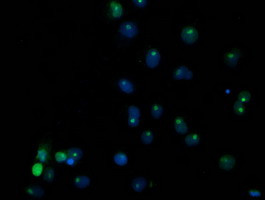 SSX1 Antibody in Immunocytochemistry (ICC/IF)