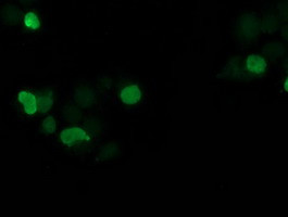 SSX1 Antibody in Immunocytochemistry (ICC/IF)