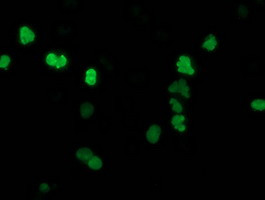 SSX1 Antibody in Immunocytochemistry (ICC/IF)