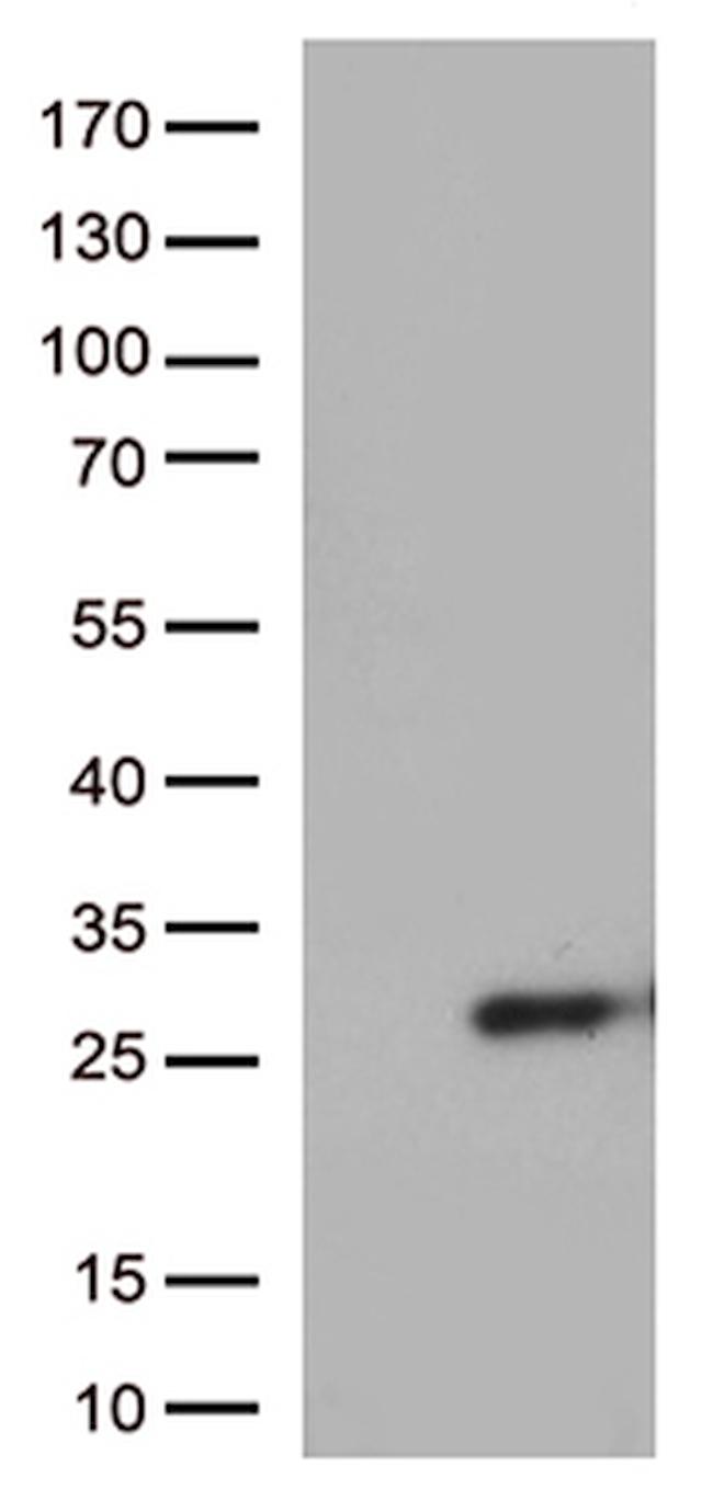 SSX4B Antibody in Western Blot (WB)