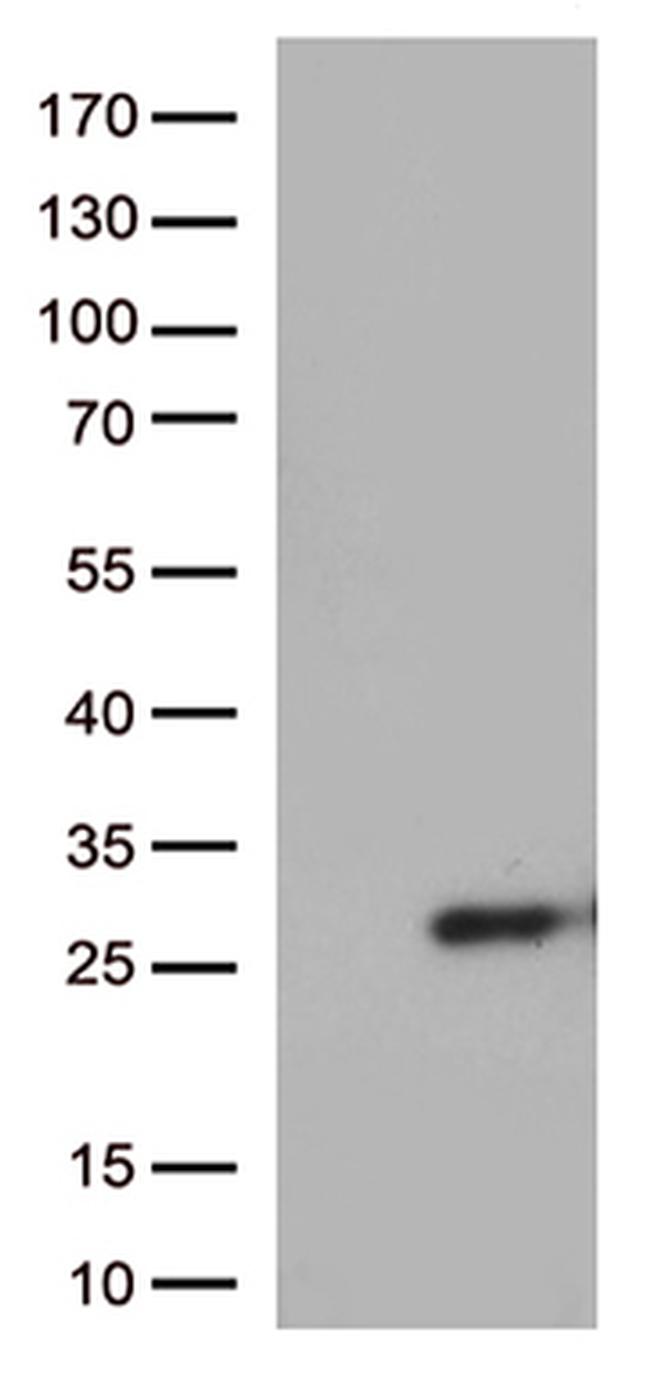 SSX4B Antibody in Western Blot (WB)
