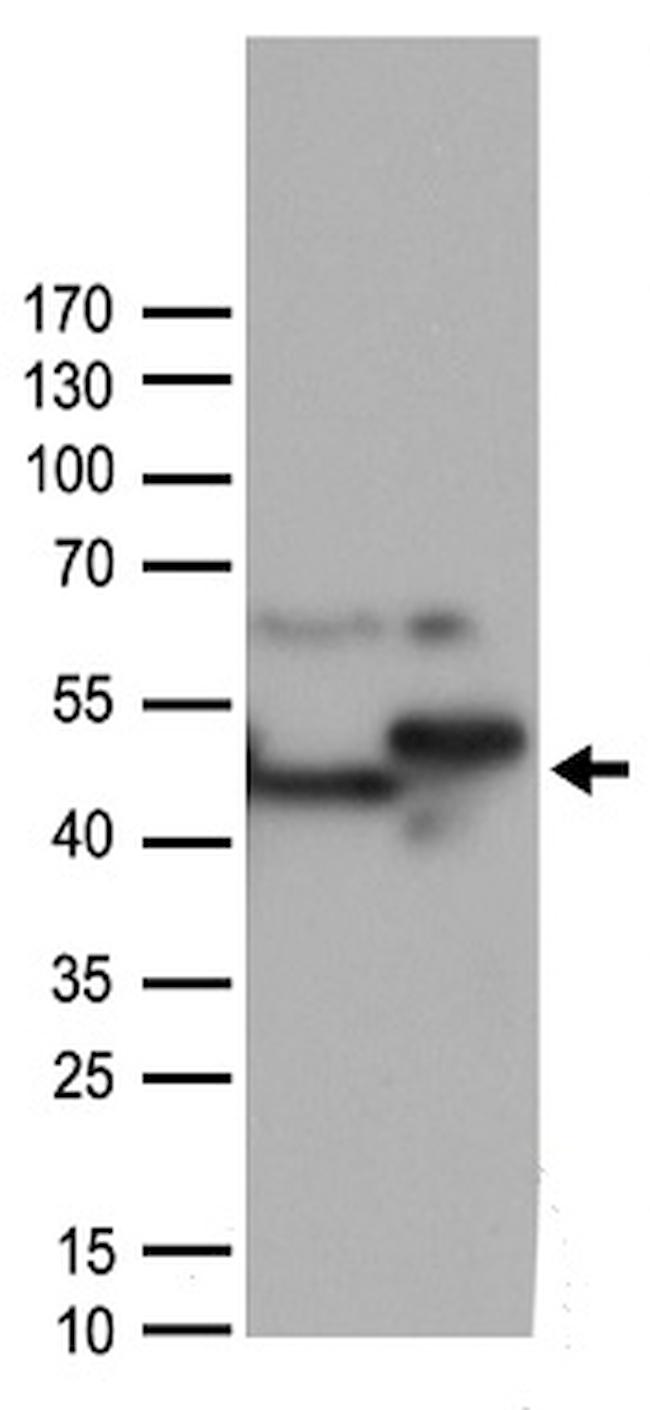 ST13 Antibody in Western Blot (WB)