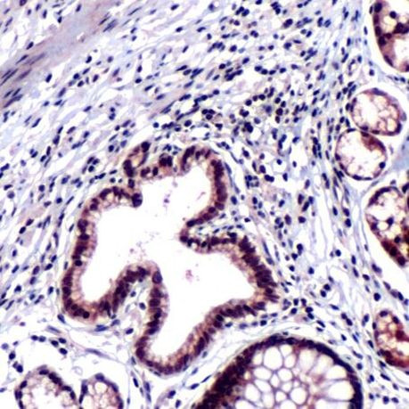 HIP Antibody in Immunohistochemistry (IHC)
