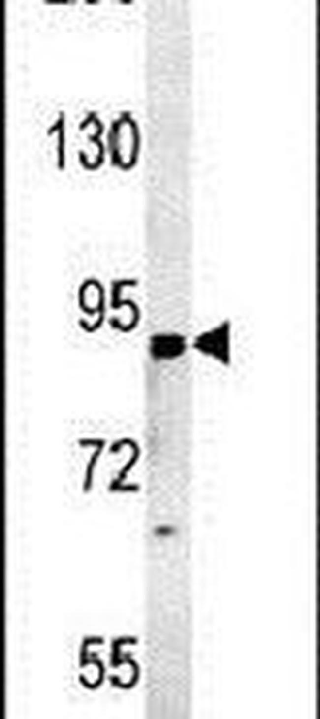 ST18 Antibody in Western Blot (WB)