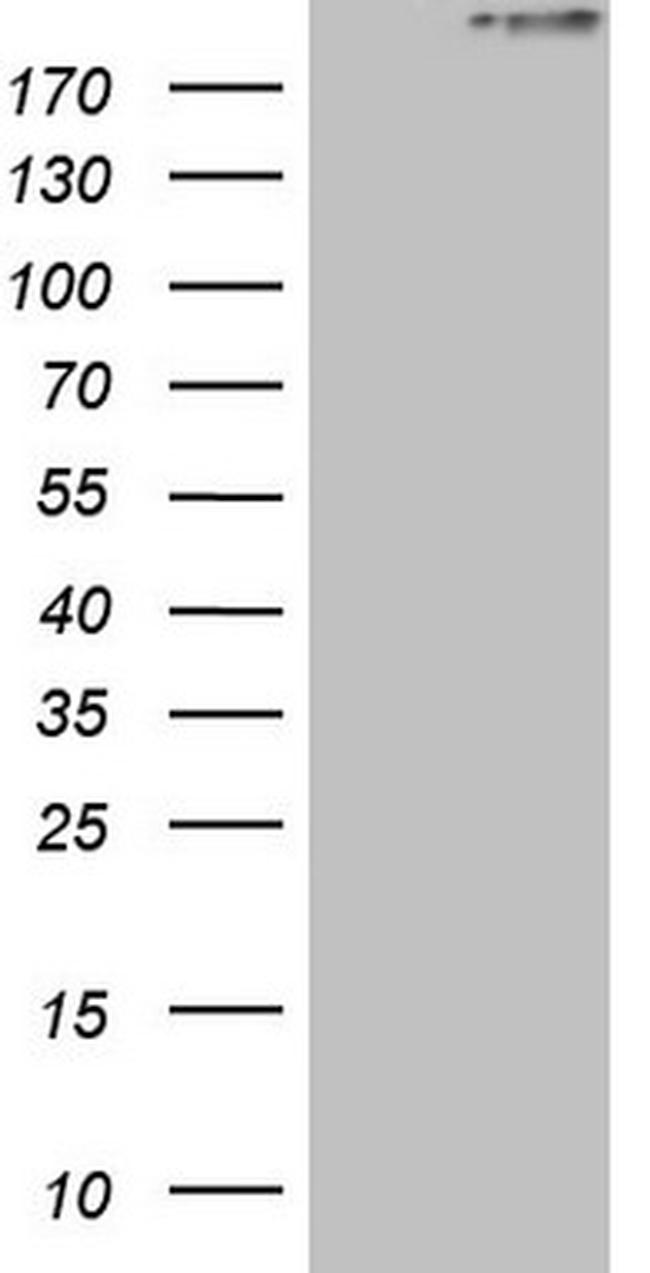 STAB2 Antibody in Western Blot (WB)