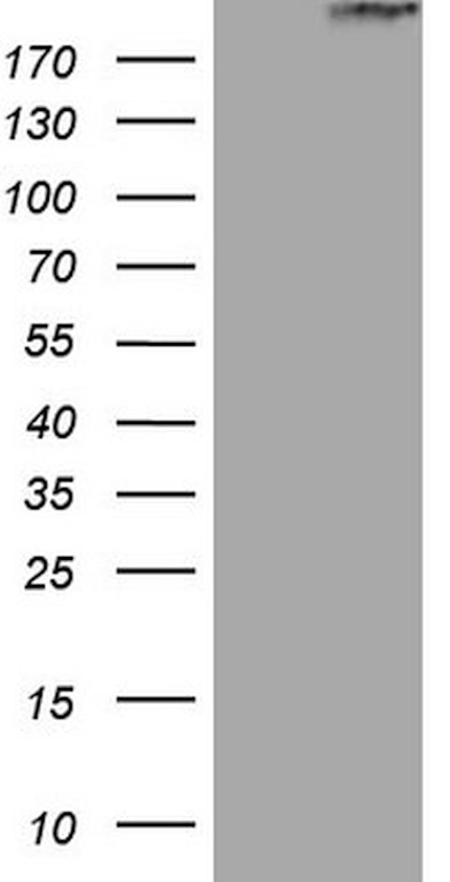 STAB2 Antibody in Western Blot (WB)