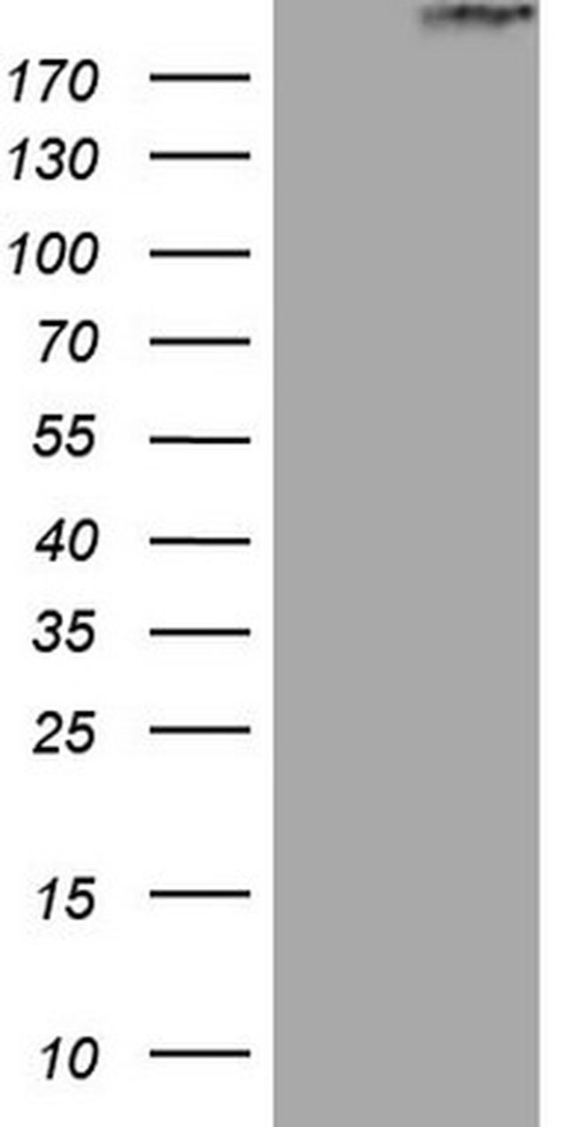 STAB2 Antibody in Western Blot (WB)