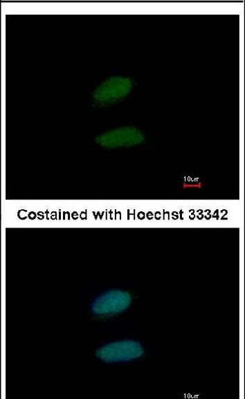 STAG1 Antibody in Immunocytochemistry (ICC/IF)