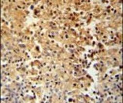 STAMBPL1 Antibody in Immunohistochemistry (IHC)