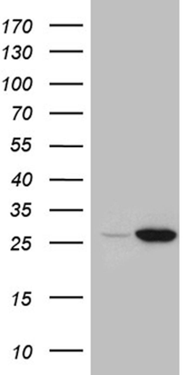 STARD4 Antibody in Western Blot (WB)