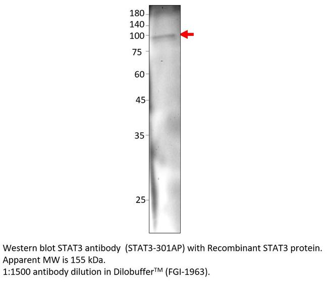 STAT3 Antibody in Western Blot (WB)