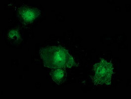STAT5A Antibody in Immunocytochemistry (ICC/IF)