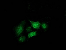 STAT5A Antibody in Immunocytochemistry (ICC/IF)