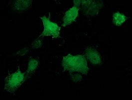 STAT5A Antibody in Immunocytochemistry (ICC/IF)