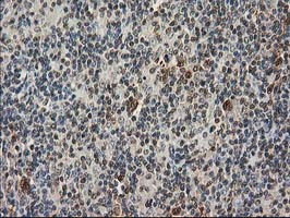 STAT5A Antibody in Immunohistochemistry (Paraffin) (IHC (P))