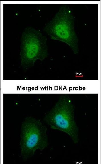STAT5B Antibody in Immunocytochemistry (ICC/IF)