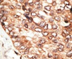 STAT5 beta Antibody in Immunohistochemistry (IHC)