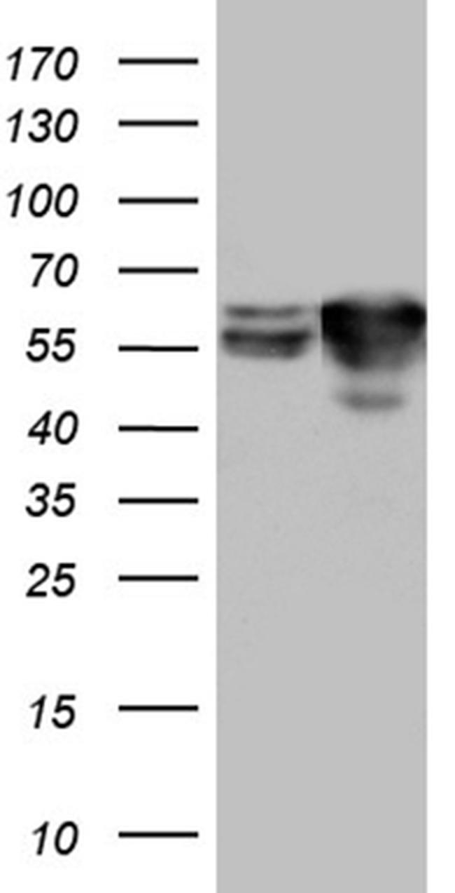 STAU1 Antibody in Western Blot (WB)