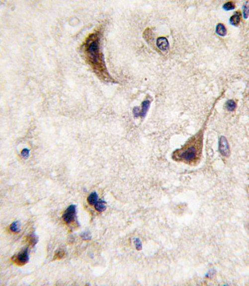 STEP Antibody in Immunohistochemistry (IHC)